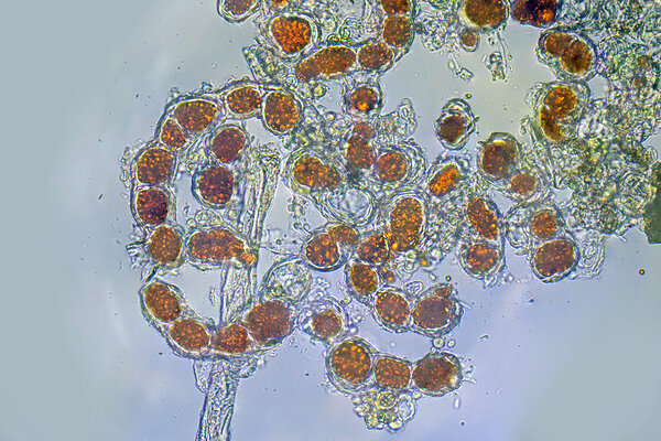 Niitjas rohevetikas Trentepohlia (Trentepohlia umbrina) mikroskoobi all.Trentepohlia ühe ümara raku läbimõõt on umbes 20 mikromeetrit (0,02 mm)  